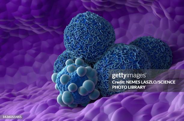 pancreatic cancer, illustration - pancreatic cancer stock illustrations