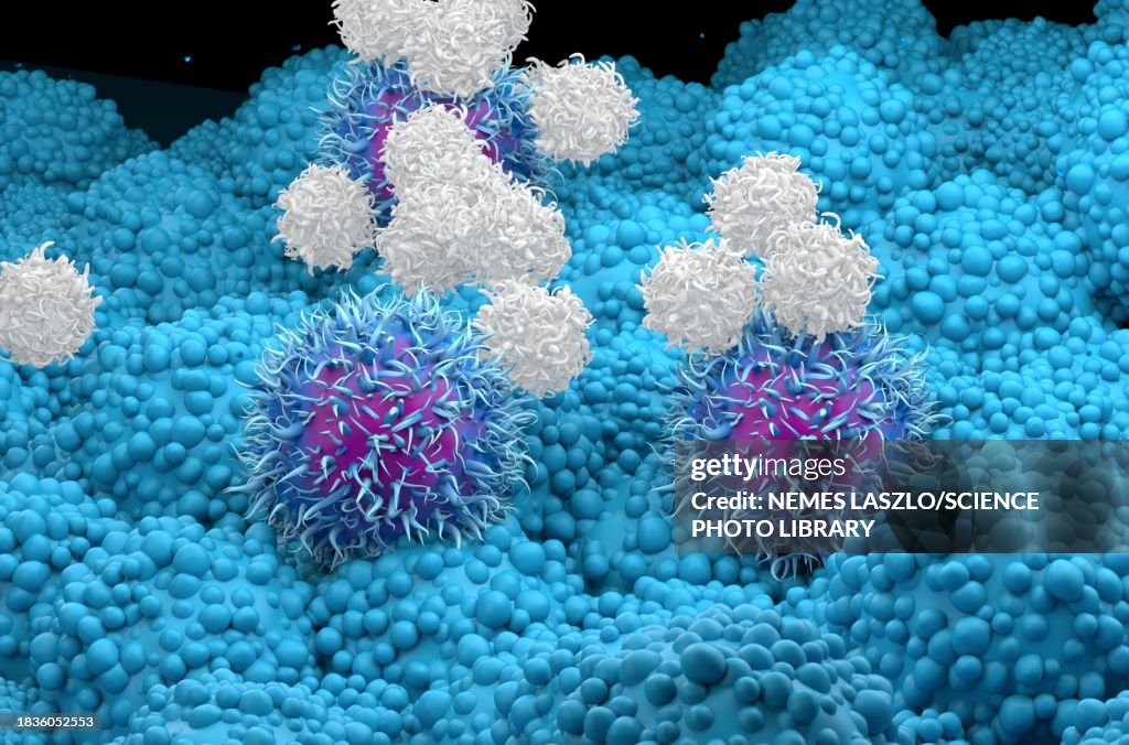 T cells attacking pancreatic cancer cells, illustration