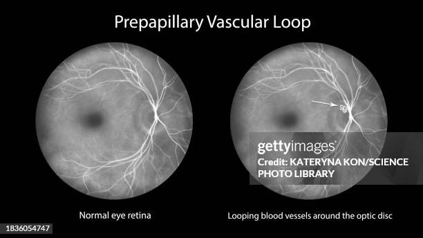 Eye Terminations Loop Illustrations, cliparts, dessins animés et icônes de Eye Loop - Getty ...