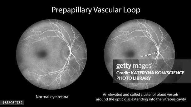 Eye Loop Drawing Illustrations, cliparts, dessins animés et icônes de Eye Loop - Getty ...