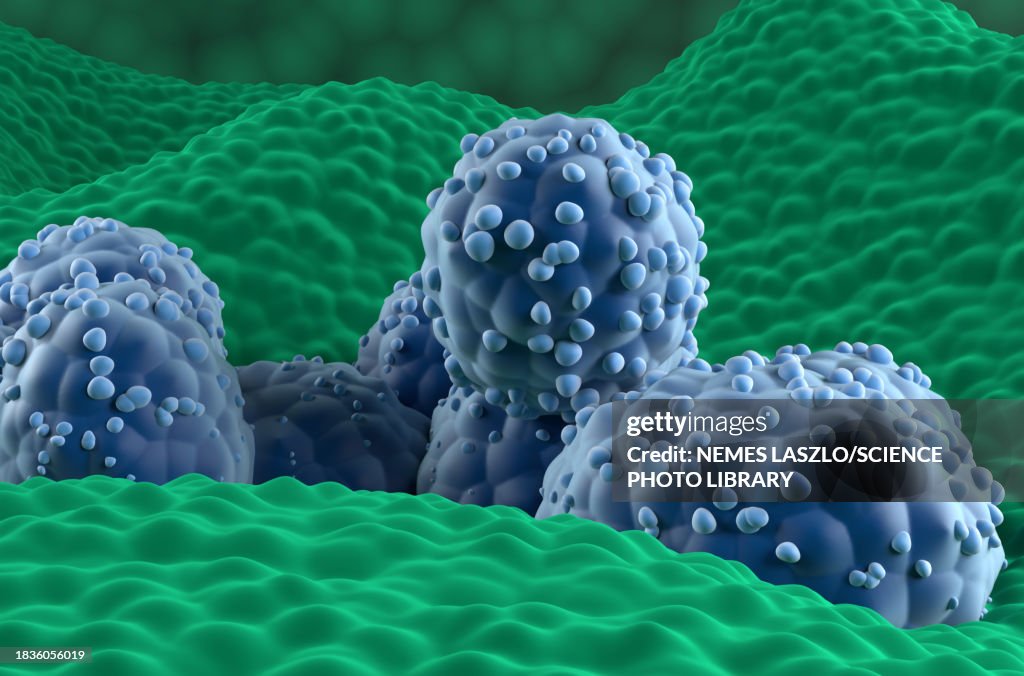 Cancre Rpr Prostate Cancer Illustration High-Res Vector Graphic - Getty Images