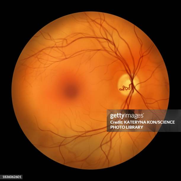 prepapillary vascular loop on the retina, illustration - fundus stock illustrations