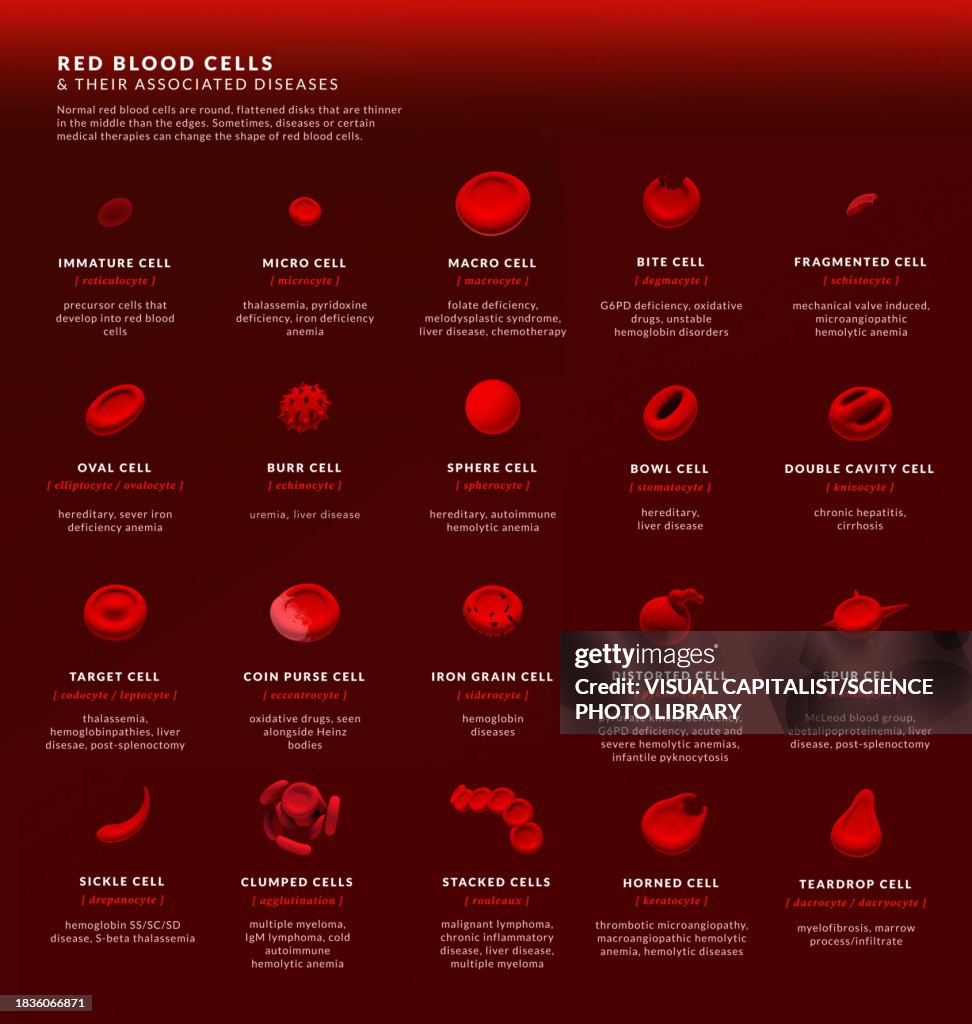Abnormal Rbc Sample Forms Of Abnormal Red Blood Cell Illustration High-Res Vector Graphic ...