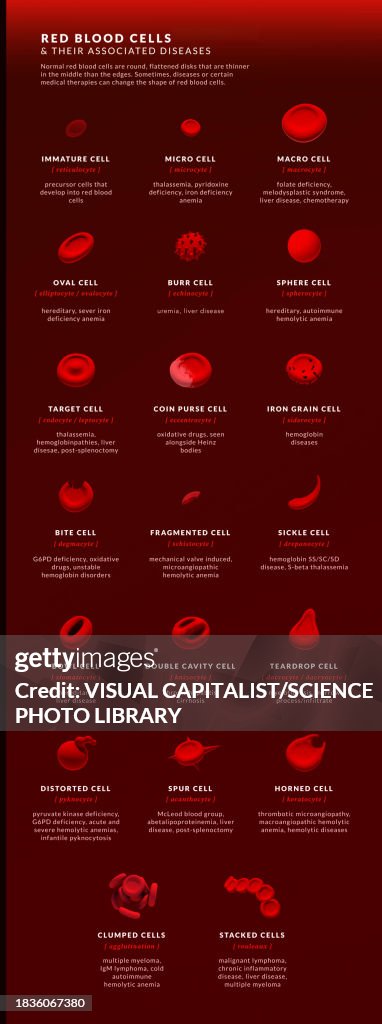 Abnormal Rbc Cell Forms Of Abnormal Red Blood Cell Illustration High-Res Vector Graphic ...
