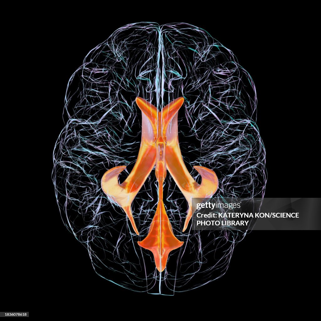 Ventricular system of the brain, illustration