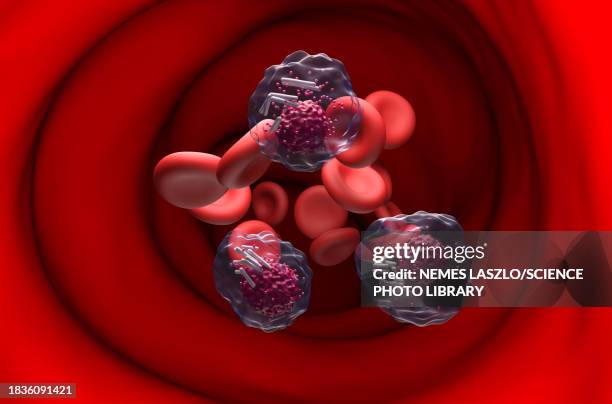 auer rods in acute promyelocytic leukaemia, illustration - bone marrow stock illustrations