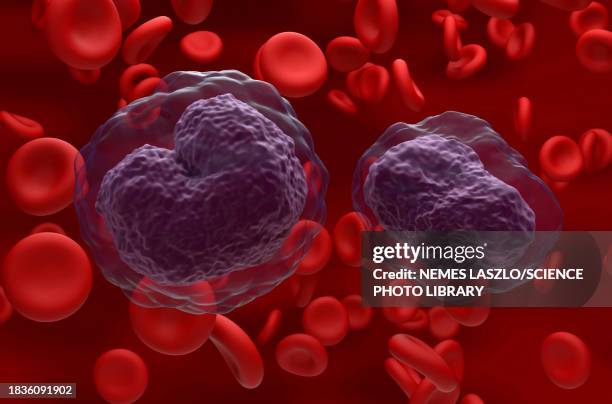 non-hodgkin's lymphoma cells, illustration - human blood stock illustrations