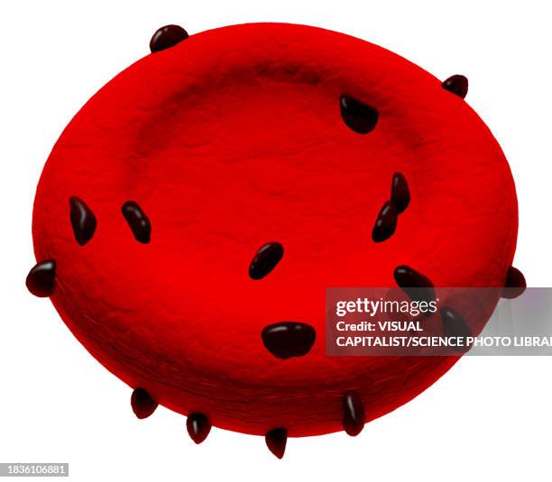 siderocyte abnormal red blood cell, illustration - sickle cell stock illustrations