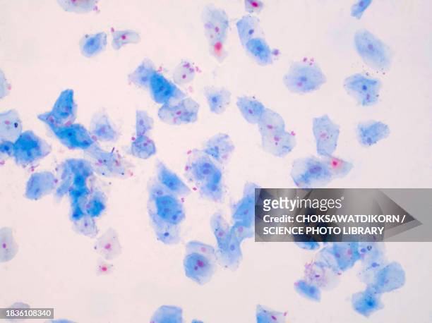 squamous epithelial cells, light micrograph - cervix fotografías e imágenes de stock