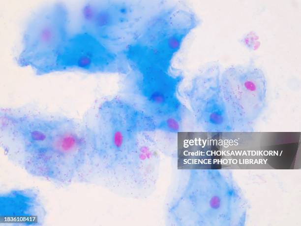 squamous epithelial cells, light micrograph - squamous epithelium stock pictures, royalty-free photos & images