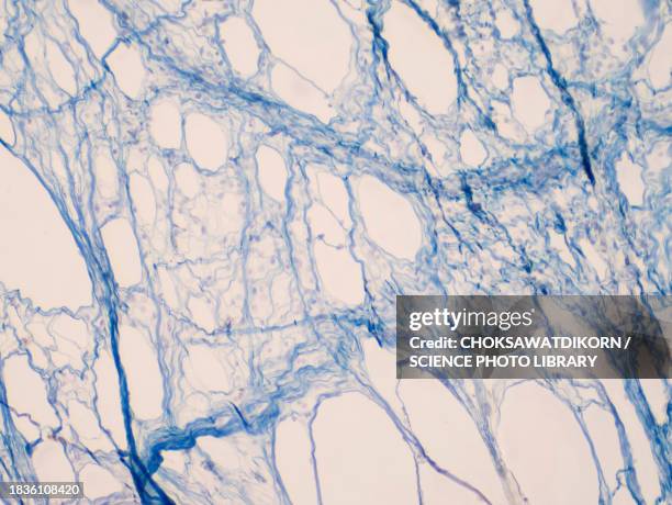 areolar connective tissue, light micrograph - tecido conjuntivo reticular imagens e fotografias de stock