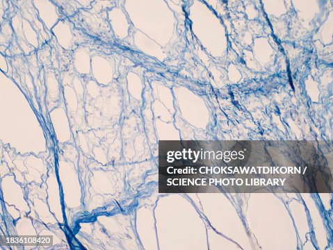 Areolar connective tissue, light micrograph Areolar connective tissue, light micrograph