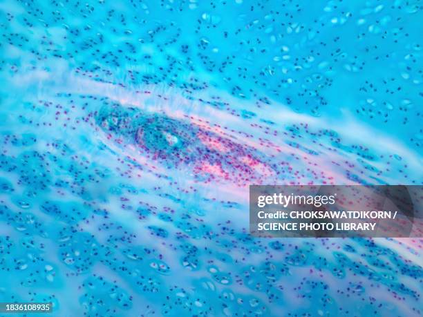 human hyaline cartilage, light micrograph - immunofluorescentie microfoto stockfoto's en -beelden