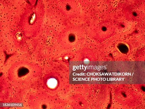 Human compact bone tissue, light micrograph Human compact bone tissue, light micrograph