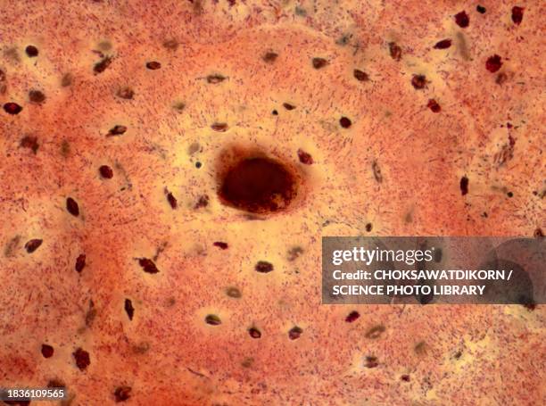 human compact bone tissue, light micrograph - micrografía científica fotografías e imágenes de stock