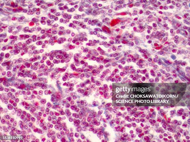 human liver tissue, light micrograph - microphotographie immunofluorescente photos et images de collection