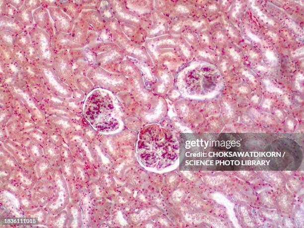 human kidney, light micrograph - tubules stock pictures, royalty-free photos & images