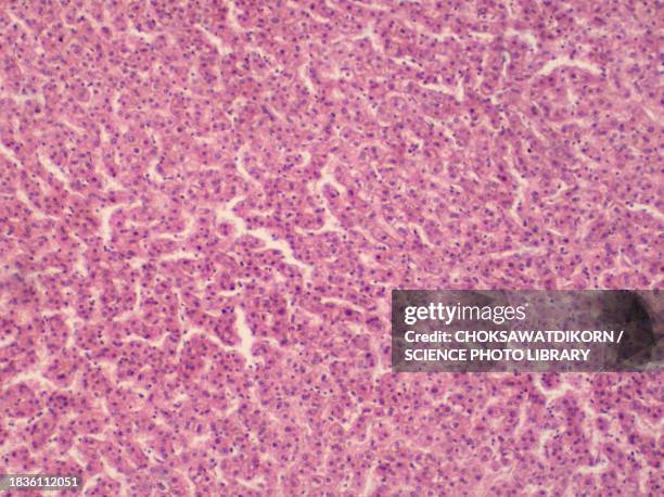 human liver tissue, light micrograph - histologia imagens e fotografias de stock