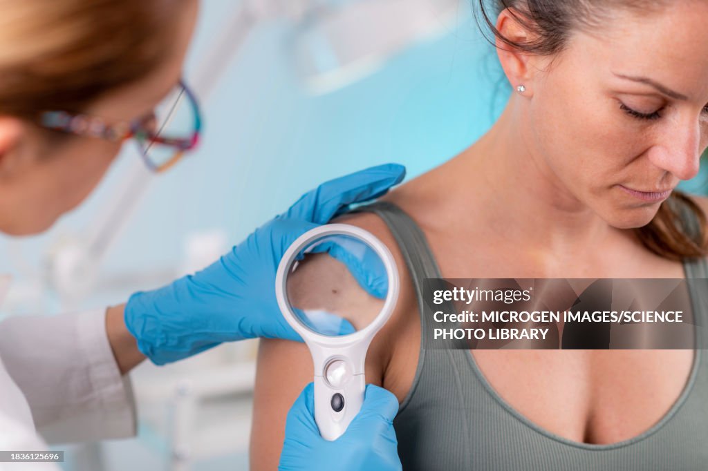 Dermatologist checking mole