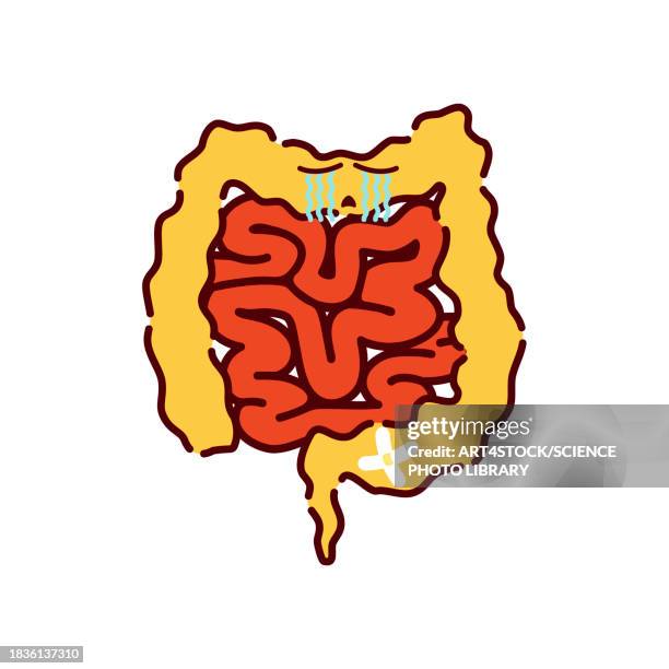 ulcerative colitis, conceptual illustration - diarrhea stock illustrations