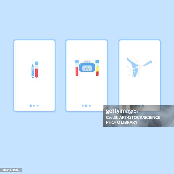 platelet-rich plasma, conceptual illustration - knee injection stock illustrations