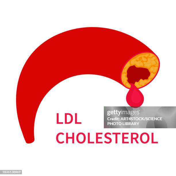 ldl cholesterol, conceptual illustration - high density lipoprotein stock illustrations