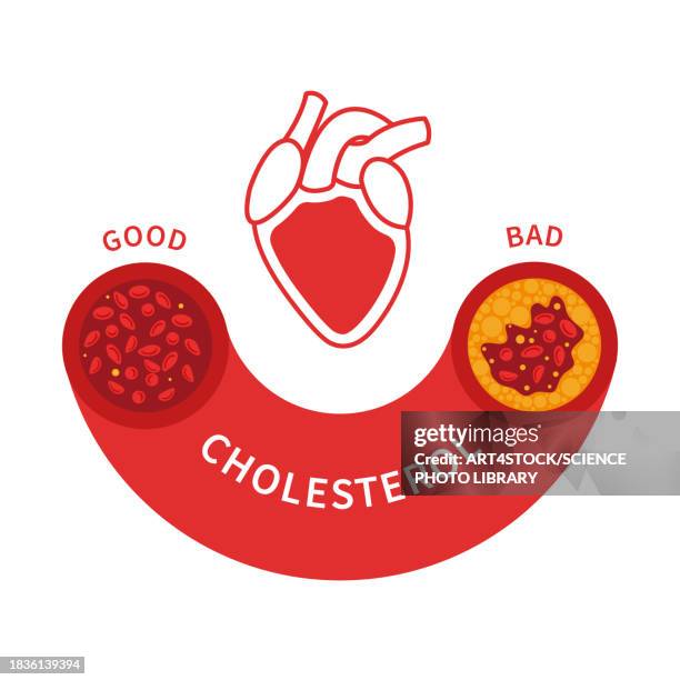 cholesterol levels, conceptual illustration - high density lipoprotein stock illustrations