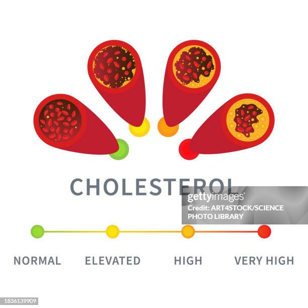 cholesterol levels, conceptual illustration - coronary artery点のイラスト素材／クリップアート素材／マンガ素材／アイコン素材