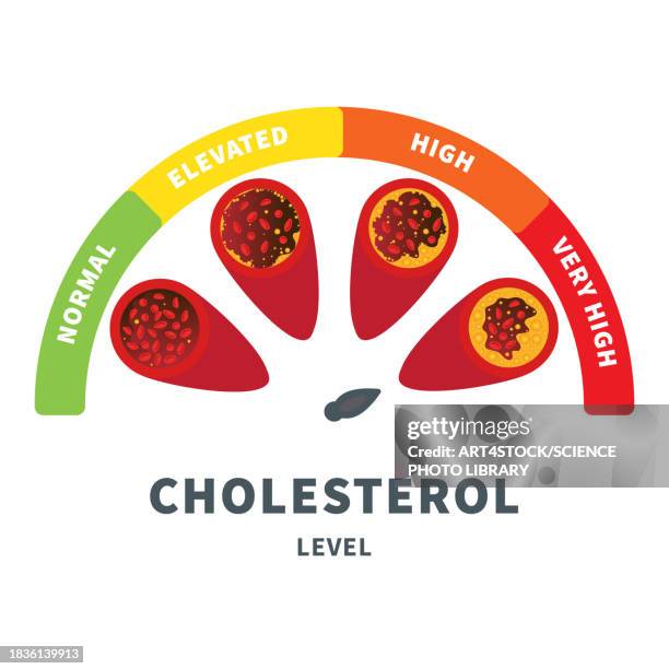 atherosclerosis, conceptual illustration - high density lipoprotein stock illustrations