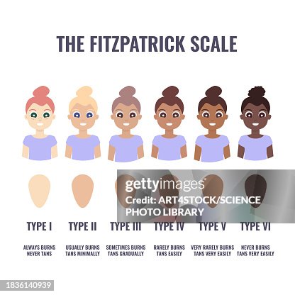 Fitzpatrick Skin Type Classification Illustration High-Res Vector ...
