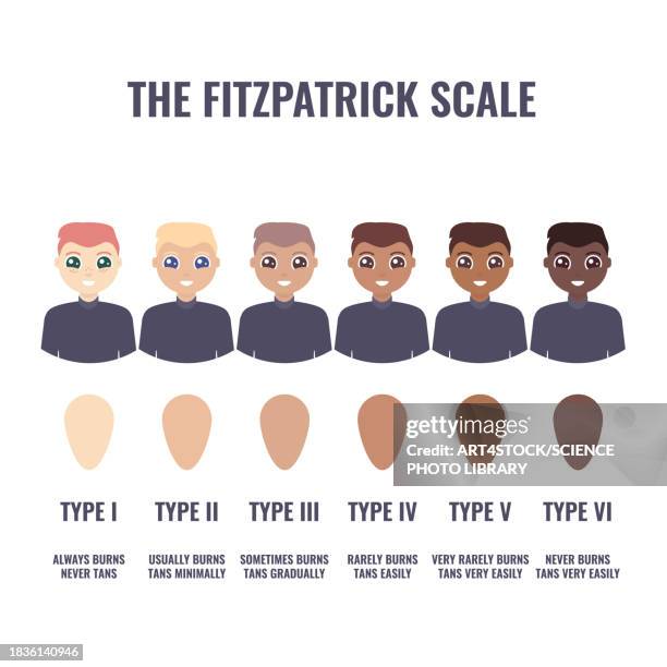 fitzpatrick skin type classification, illustration - hyperpigmentation stock illustrations