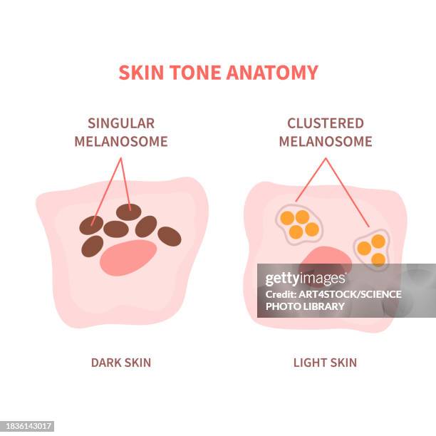 skin tone, conceptual illustration - hyperpigmentation stock illustrations