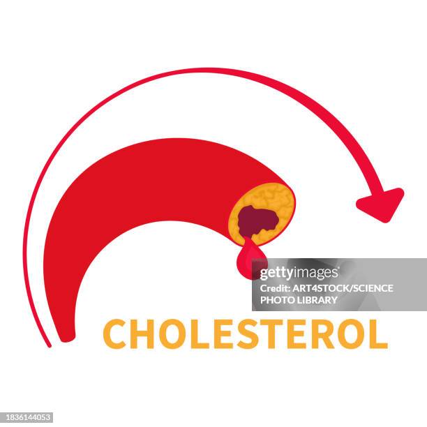 high cholesterol, conceptual illustration - low cholesterol stock illustrations