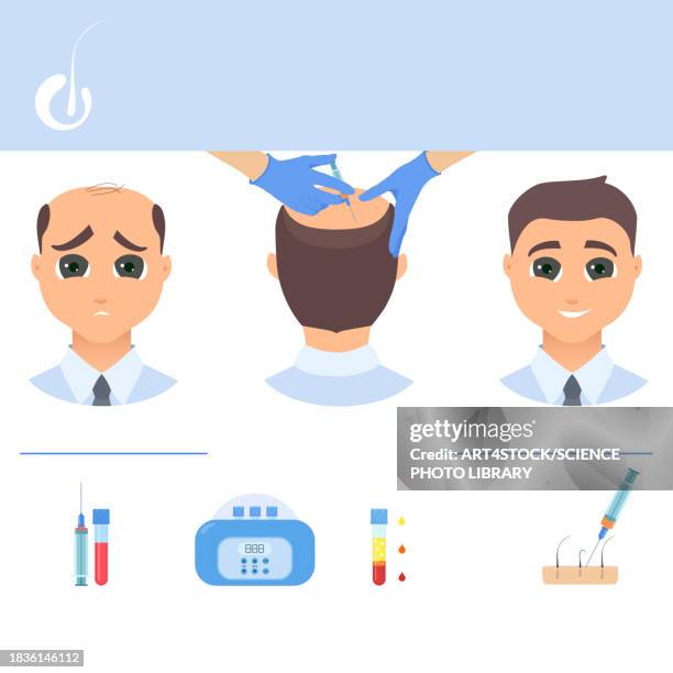 prp for hair loss treatment, conceptual illustration - operations management stock illustrations