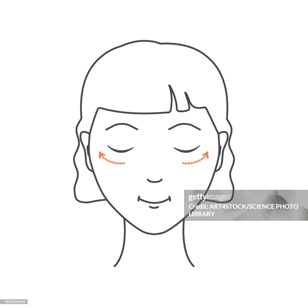 Blepharoplasty, conceptual illustration