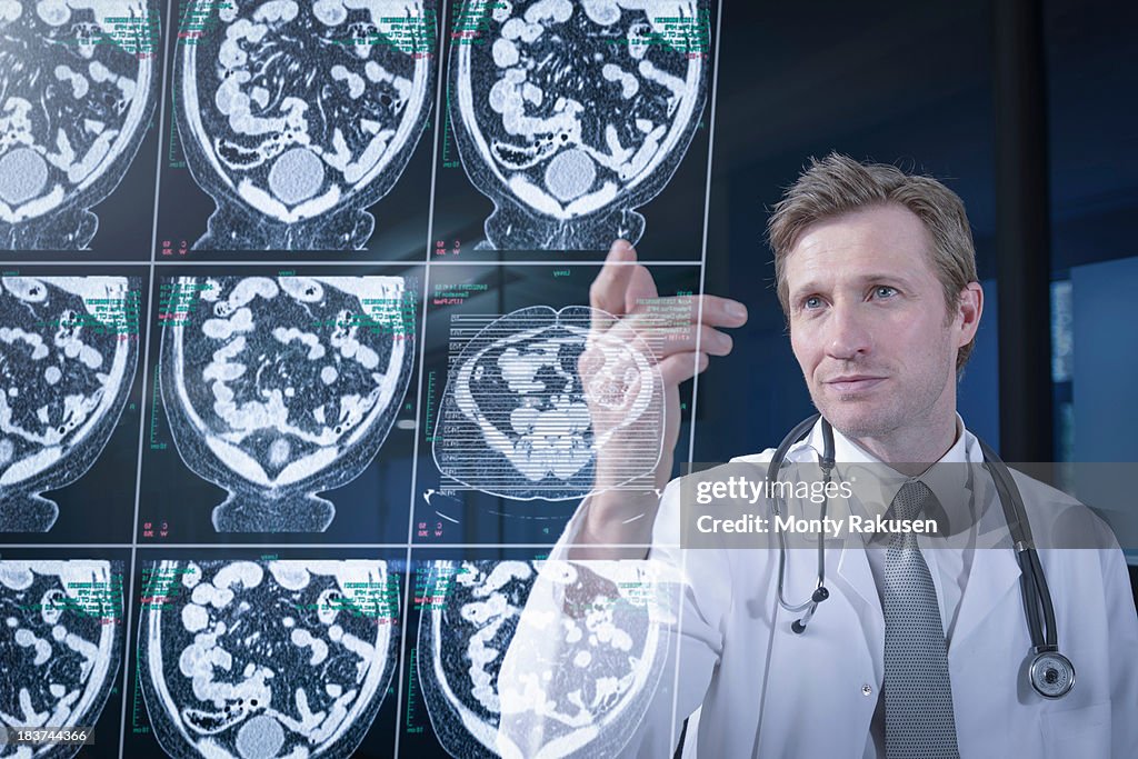 Doctor looking at computed tomography (CT) scans on screen