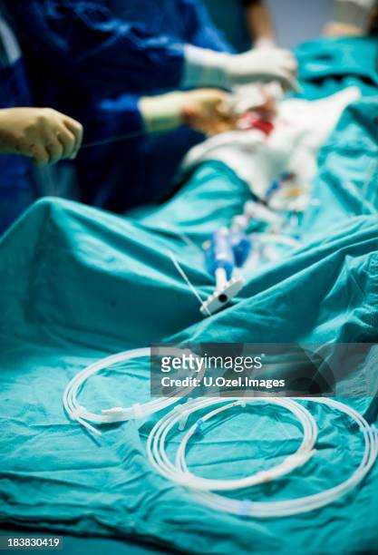 operación quirúrgica - stent fotografías e imágenes de stock