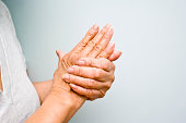 Elderly woman grasping arthritic hands
