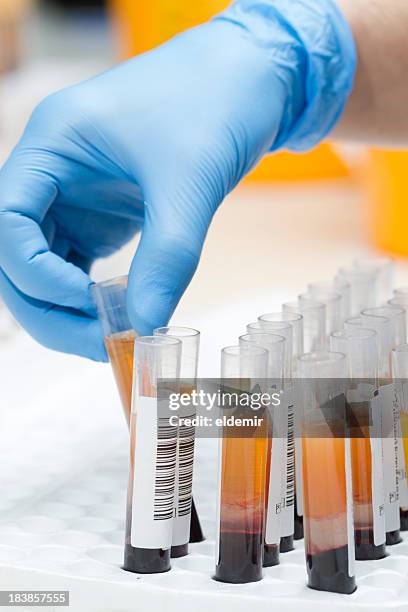 a lab technician with donation tests - blood plasma stock pictures, royalty-free photos & images