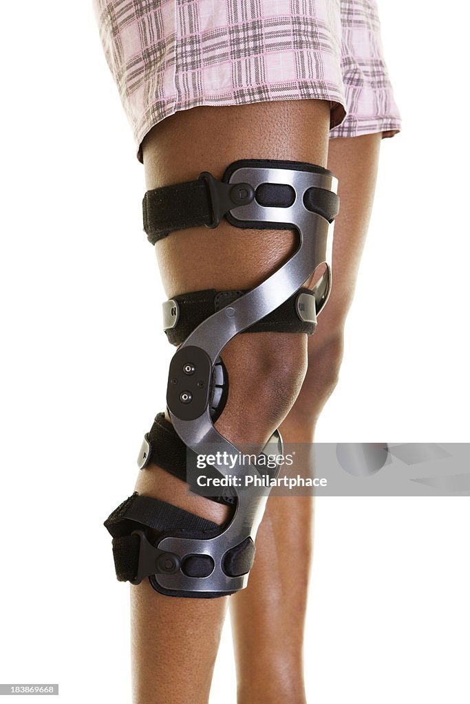 Weibliche Beine mit Knochenschiene