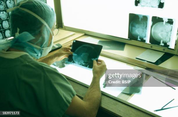 Brain Electrostimulation, Precise Targetting For The Optimal Placement Of Stimulation Electrodes, Bilateral Thalamic Stimulation Is Used To Treat...