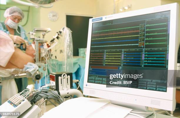 Brain Electrostimulation, Generally Executed Under Local Anesthesia, Except In Cases Like This One, Where The Patient Is Under General Anesthesia,...