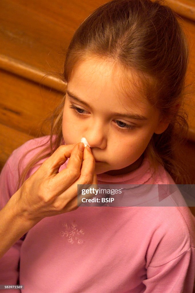 Child With Nosebleed