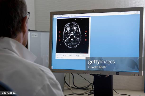 Skull, Scan, Regional Hospital Complex Of Lille, France, Department Of Neurosurgery, Treatment Of An Acoustic Neuroma By Stereotaxic Radiosurgery,...