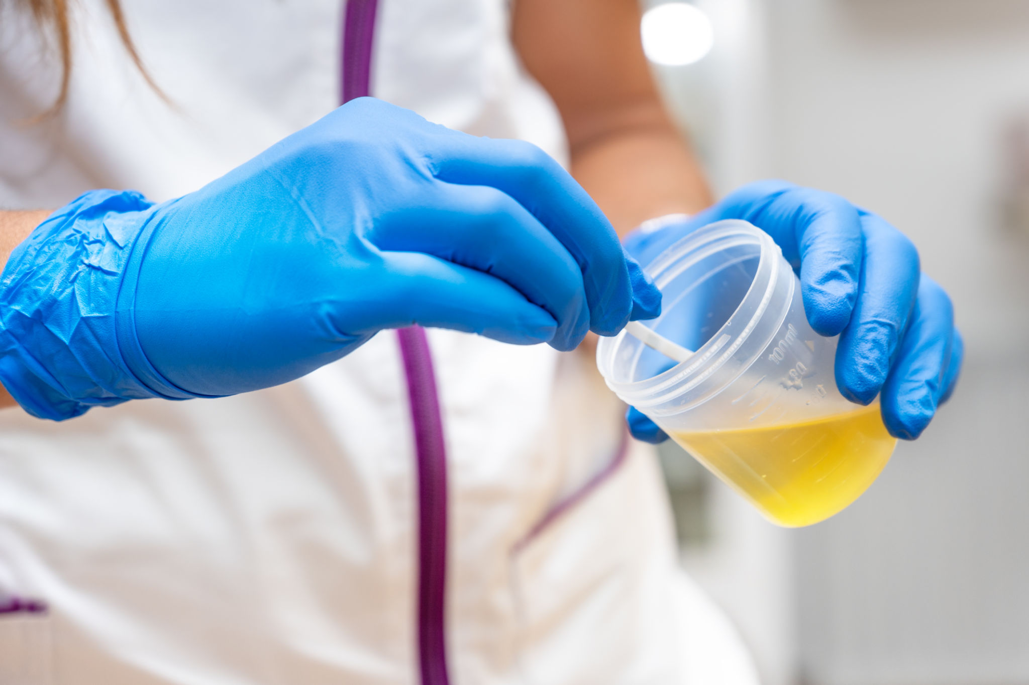 urine test