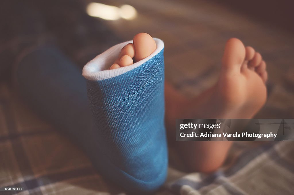 Foot cast