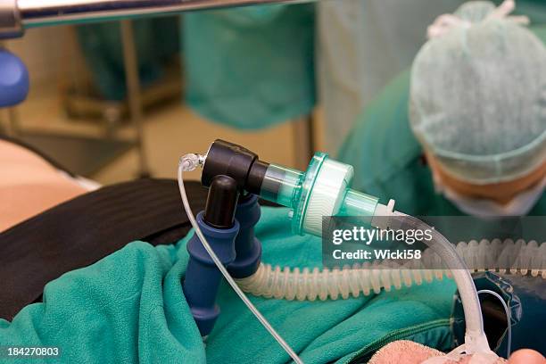 patient with tracheal intubation - intubatie stockfoto's en -beelden