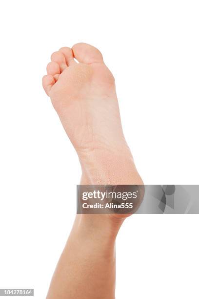 dry and cracked woman's heel on white background - female feet soles stockfoto's en -beelden