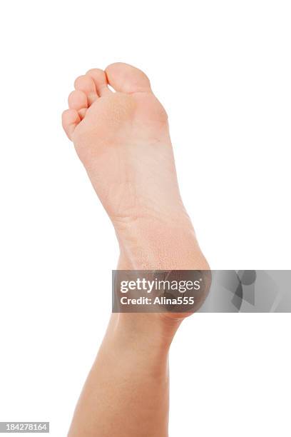dry and cracked woman's heel on white background - sole of foot bildbanksfoton och bilder