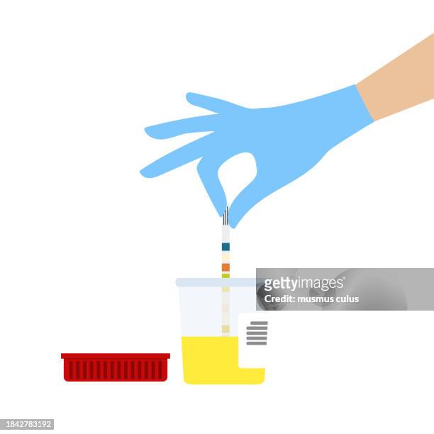 urinprobe, urintest, menschliche hand, die die harnstoffmenge im urin misst - urine sample stock-grafiken, -clipart, -cartoons und -symbole